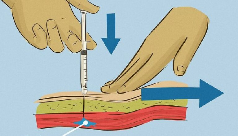 Stem Cell Injection Techniques for Aesthetic Providers